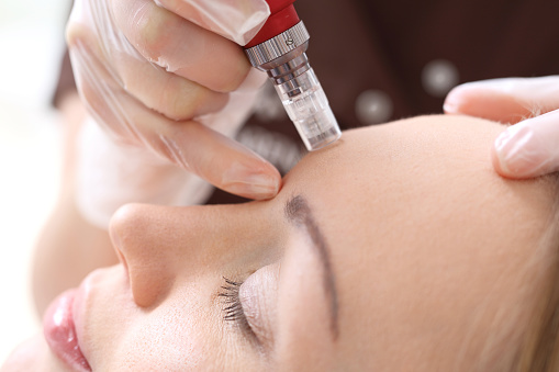 microneedling aftercare