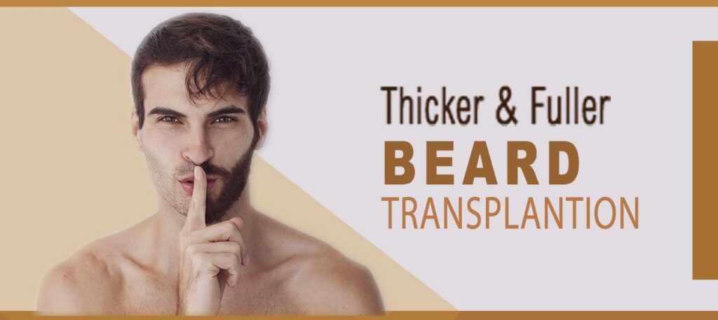 beard transplant