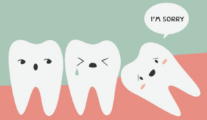 Risks of removing your wisdom teeth